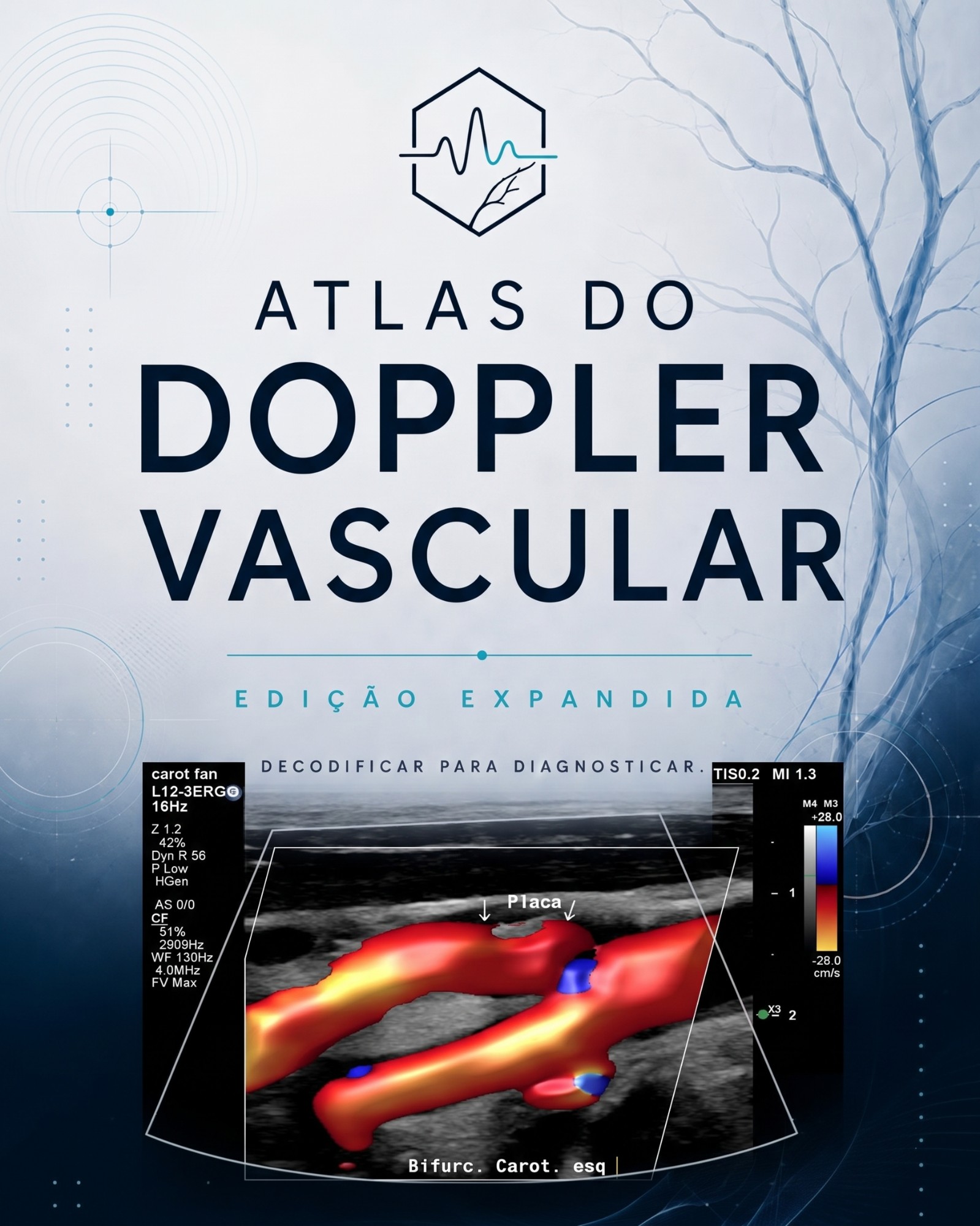 Capa do Atlas do Doppler Vascular, edição expandida, com uma bifurcação carotídea no Doppler colorido